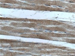 HKDC1 Rabbit anti-Human, Mouse, Polyclonal, Proteintech 150 &mu;L; Unconjugated:Antibodies,