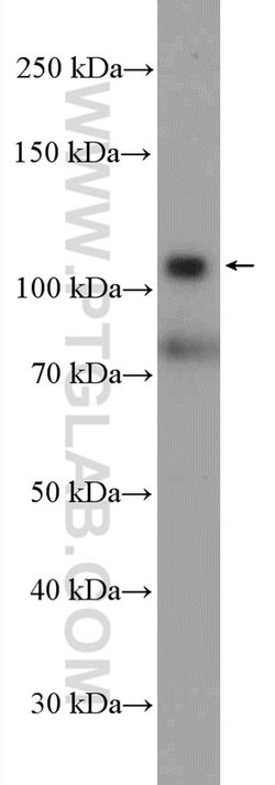 HKDC1 Rabbit anti-Human, Mouse, Polyclonal, Proteintech 150 &mu;L; Unconjugated:Antibodies,