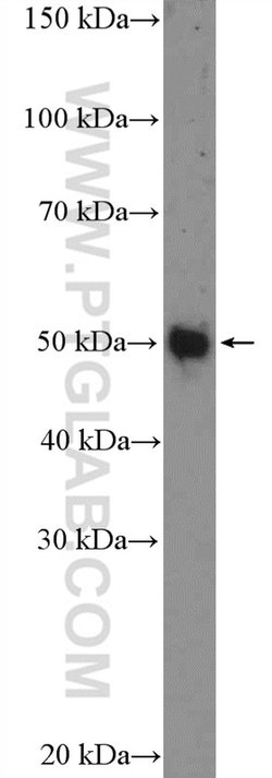 Whirlin Rabbit anti-Human, Polyclonal, Proteintech 150 &mu;L | Buy Online | Proteintech Group Inc | Fisher Scientific