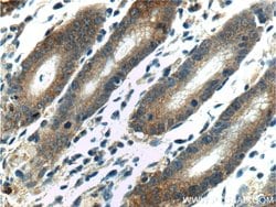 LIPF Rabbit anti-Human, Polyclonal, Proteintech 150 &mu;L; Unconjugated:Antibodies,