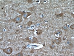 TRPC5 Rabbit anti-Human, Mouse, Polyclonal, Proteintech:Antibodies:Primary