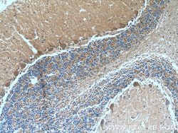 TRPC5 Rabbit anti-Human, Mouse, Polyclonal, Proteintech:Antibodies:Primary