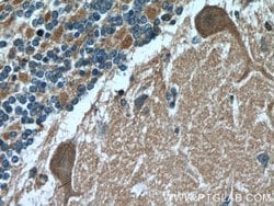 TRPC5 Rabbit anti-Human, Mouse, Polyclonal, Proteintech:Antibodies:Primary