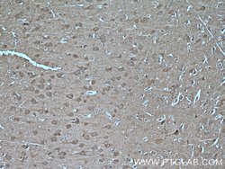 TRPC5 Rabbit anti-Human, Mouse, Polyclonal, Proteintech:Antibodies:Primary