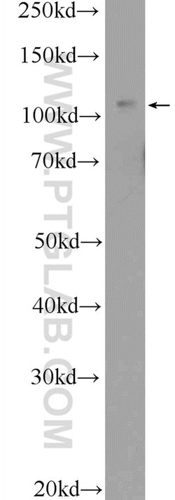 TRPC5 Rabbit anti-Human, Mouse, Polyclonal, Proteintech:Antibodies:Primary