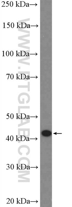 CCR7 Rabbit anti-Human, Rat, Polyclonal, Proteintech 150 &mu;L; Unconjugated:Antibodies,
