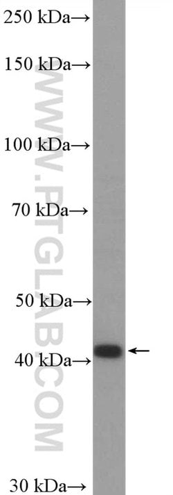 CCR7 Rabbit anti-Human, Rat, Polyclonal, Proteintech 150 &mu;L; Unconjugated:Antibodies,