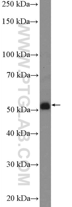 GABRR1 Rabbit anti-Human, Mouse, Polyclonal, Proteintech 150 &mu;L; Unconjugated:Antibodies,