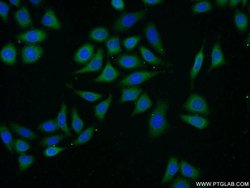 APOL2 Rabbit anti-Human, Polyclonal, Proteintech 150 &mu;L; Unconjugated:Antibodies,