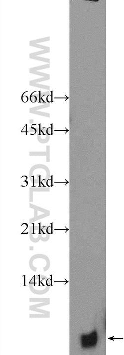 PCP4L1 Rabbit anti-Human, Mouse, Rat, Polyclonal, Proteintech:Antibodies:Primary