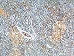 Thumbnail_C11orf80 Rabbit anti-Human, Polyclonal, Proteintech 20 &mu;L; Unconjugated:Antibodies,