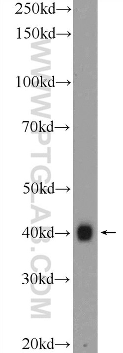 Icln Rabbit anti-Canine, Human, Polyclonal, Proteintech 20 &mu;L | Buy Online | Proteintech | Fisher Scientific
