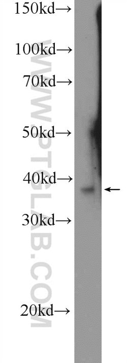 Icln Rabbit anti-Canine, Human, Polyclonal, Proteintech 20 &mu;L | Buy Online | Proteintech | Fisher Scientific