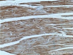 JPH1 Rabbit anti-Human, Mouse, Polyclonal, Proteintech 20 &mu;L; Unconjugated:Antibodies,