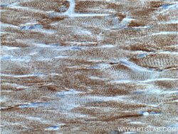 JPH1 Rabbit anti-Human, Mouse, Polyclonal, Proteintech 20 &mu;L; Unconjugated:Antibodies,