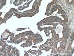 TMEM184A Rabbit anti-Human, Polyclonal, Proteintech:Antibodies:Primary