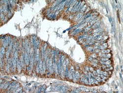 TMEM184A Rabbit anti-Human, Polyclonal, Proteintech:Antibodies:Primary