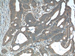 XBP1 Rabbit anti-Human, Mouse, Rat, Polyclonal, Proteintech 150 &mu;L;