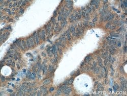 XBP1 Rabbit anti-Human, Mouse, Rat, Polyclonal, Proteintech 150 &mu;L;