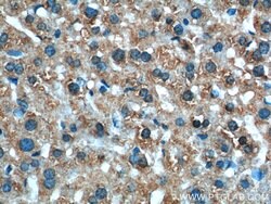 XBP1 Rabbit anti-Human, Mouse, Rat, Polyclonal, Proteintech 150 &mu;L;
