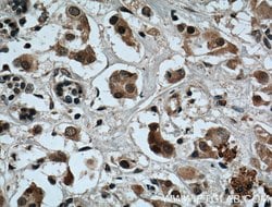 XBP1 Rabbit anti-Human, Mouse, Rat, Polyclonal, Proteintech 150 &mu;L;