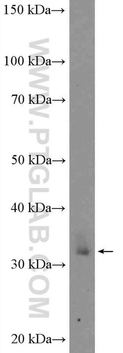 XBP1 Rabbit anti-Human, Mouse, Rat, Polyclonal, Proteintech 150 &mu;L;