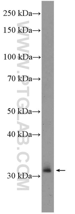 XBP1 Rabbit anti-Human, Mouse, Rat, Polyclonal, Proteintech 150 &mu;L;