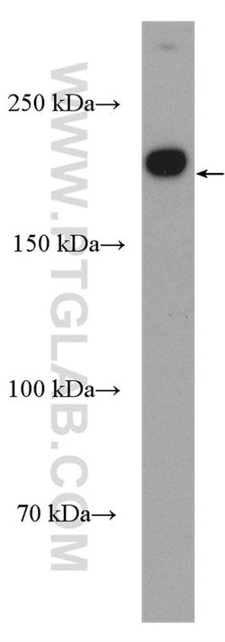 KIF14 Rabbit anti-Human, Polyclonal, Proteintech 150 &mu;L; Unconjugated:Anticuerpos
