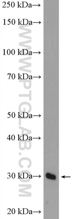 CPXCR1 Rabbit anti-Human, Mouse, Polyclonal, Proteintech 150 &mu;L | Buy Online | Proteintech Group Inc | Fisher Scientific