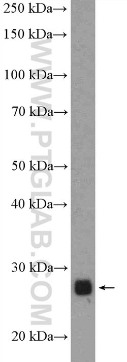 CPXCR1 Rabbit anti-Human, Mouse, Polyclonal, Proteintech 150 &mu;L | Buy Online | Proteintech Group Inc | Fisher Scientific