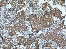 KIAA0090 Rabbit anti-Human, Polyclonal, Proteintech:Antibodies:Primary