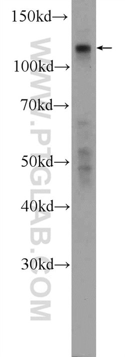 KIAA0090 Rabbit anti-Human, Polyclonal, Proteintech:Antibodies:Primary