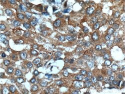 KIAA0090 Rabbit anti-Human, Polyclonal, Proteintech:Antibodies:Primary