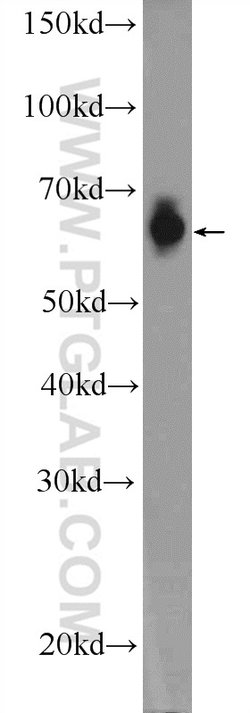 FAM116B Rabbit anti-Human, Polyclonal, Proteintech 150 &mu;L; Unconjugated:Antibodies,