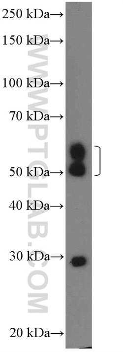 CHST2 Rabbit anti-Human, Mouse, Polyclonal, Proteintech:Antibodies:Primary