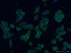 IGSF2 Rabbit anti-Human, Mouse, Polyclonal, Proteintech 150 &mu;L | Buy Online | Proteintech Group Inc | Fisher Scientific