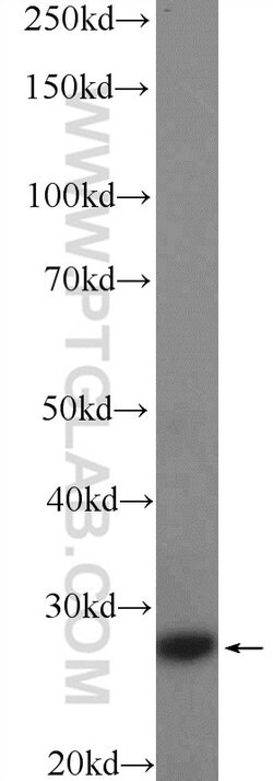 CFD Rabbit anti-Human, Polyclonal, Proteintech:Antibodies:Primary Antibodies