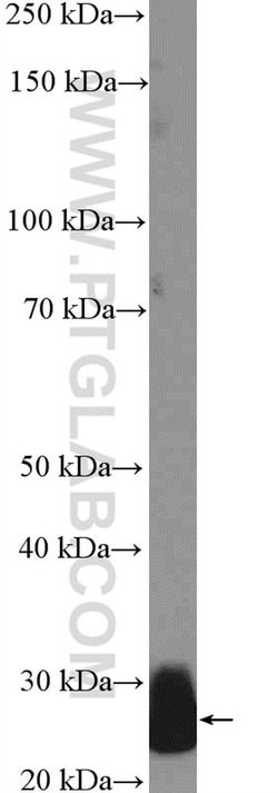 CFD Rabbit anti-Human, Polyclonal, Proteintech:Antibodies:Primary Antibodies