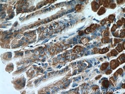 Ezrin Rabbit anti-Human, Mouse, Polyclonal, Proteintech 150 &mu;L; Unconjugated:Antibodies,
