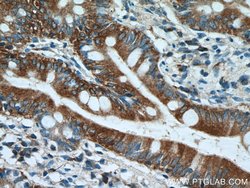 Ezrin Rabbit anti-Human, Mouse, Polyclonal, Proteintech 150 &mu;L; Unconjugated:Antibodies,