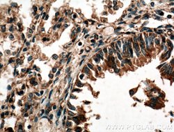 RASIP1 Rabbit anti-Human, Mouse, Rat, Polyclonal, Proteintech 150 &mu;L;