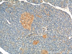 UBR1 Rabbit anti-Human, Polyclonal, Proteintech:Antibodies:Primary Antibodies