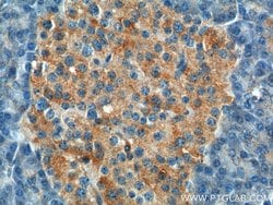 UBR1 Rabbit anti-Human, Polyclonal, Proteintech:Antibodies:Primary Antibodies