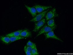 MAP9 Rabbit anti-Human, Polyclonal, Proteintech