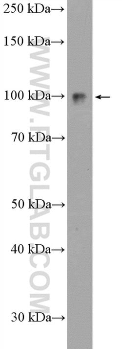 KIAA0776 Rabbit anti-Human, Polyclonal, Proteintech:Antibodies:Primary