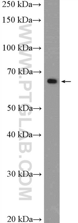 MBTD1 Rabbit anti-Human, Mouse, Polyclonal, Proteintech:Antibodies:Primary