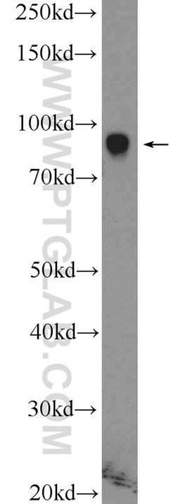 ZNF184 Rabbit anti-Human, Polyclonal, Proteintech:Antibodies:Primary Antibodies