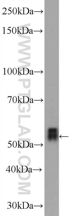 TEKT5 Rabbit anti-Human, Mouse, Polyclonal, Proteintech:Antikörper:Primärantikörper