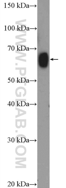 ZNF470 Rabbit anti-Human, Rat, Polyclonal, Proteintech 150 &mu;L | Buy Online | Proteintech Group Inc | Fisher Scientific
