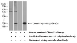 C14orf119 Rabbit anti-Human, Polyclonal, Proteintech 20 &mu;L | Buy Online | Proteintech | Fisher Scientific